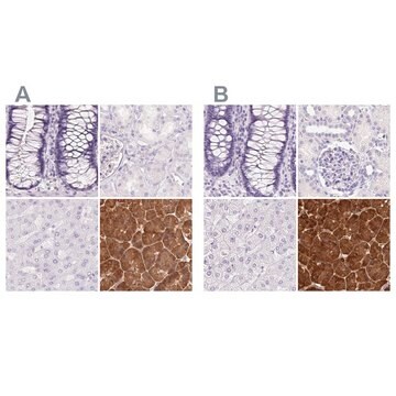 Anti-PNLIP antibody produced in rabbit Prestige Antibodies&#174; Powered by Atlas Antibodies, affinity isolated antibody, buffered aqueous glycerol solution