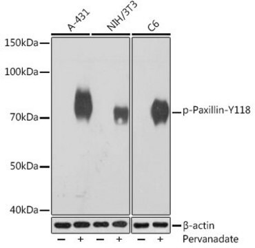 Anti-Phospho-Paxillin-Y118 antibody produced in rabbit