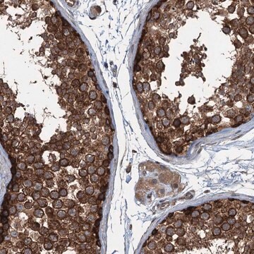 Anti-TRAPPC8 antibody produced in rabbit Prestige Antibodies&#174; Powered by Atlas Antibodies, affinity isolated antibody, buffered aqueous glycerol solution