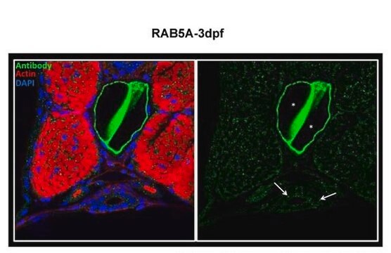 Anti-RAB5A antibody produced in rabbit affinity isolated antibody