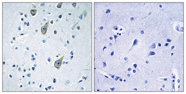 Anti-FZD6 antibody produced in rabbit affinity isolated antibody