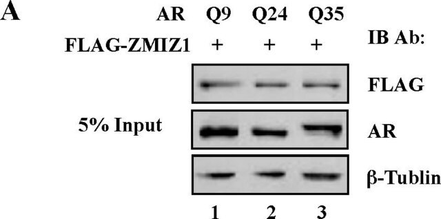 Anti-Androgen Receptor Antibody from rabbit, purified by affinity chromatography