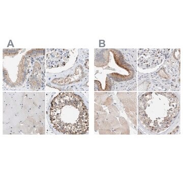 Anti-SLC38A10 antibody produced in rabbit Prestige Antibodies&#174; Powered by Atlas Antibodies, affinity isolated antibody, buffered aqueous glycerol solution, Ab2