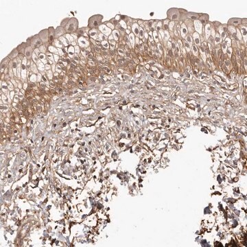 Anti-SLITRK6 antibody produced in rabbit Prestige Antibodies&#174; Powered by Atlas Antibodies, affinity isolated antibody, buffered aqueous glycerol solution