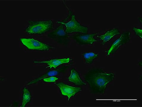 Anti-S100A10 antibody produced in mouse purified immunoglobulin, buffered aqueous solution