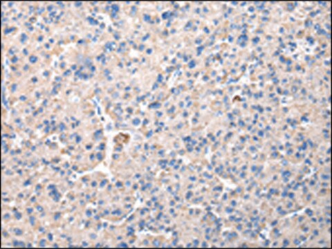 Anti-CHMP3 affinity isolated antibody