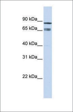 Anti-IKZF1 antibody produced in rabbit affinity isolated antibody