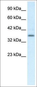 Anti-CMKLR1 antibody produced in rabbit affinity isolated antibody