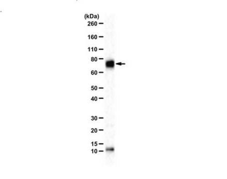 Anti-Acetyl Cortactin (Lys309) from rabbit