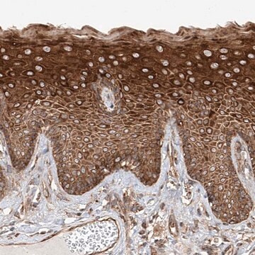 Anti-ISCA2 antibody produced in rabbit Prestige Antibodies&#174; Powered by Atlas Antibodies, affinity isolated antibody, buffered aqueous glycerol solution