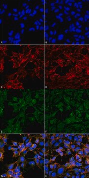 Monoclonal Anti-Malondialdehyde antibody produced in mouse clone 6H6