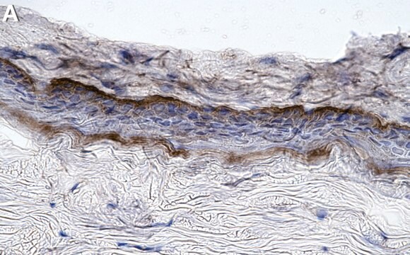 Anti-Collagen Type VII Antibody, clone NP32 ZooMAb&#174; Mouse Monoclonal recombinant, expressed in HEK 293 cells