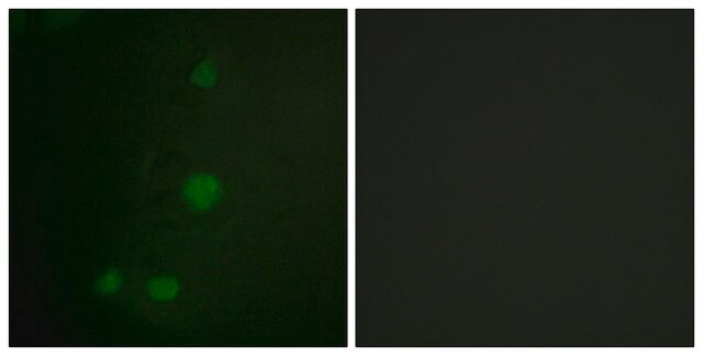 Anti-Retinoblastoma antibody produced in rabbit affinity isolated antibody