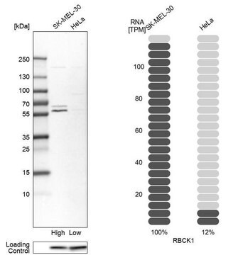 Anti-RBCK1 antibody produced in rabbit Prestige Antibodies&#174; Powered by Atlas Antibodies, affinity isolated antibody, buffered aqueous glycerol solution