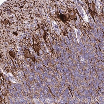 Anti-TMEM189 antibody produced in rabbit Prestige Antibodies&#174; Powered by Atlas Antibodies, affinity isolated antibody, buffered aqueous glycerol solution