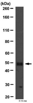 Anti-PKA RII Beta Antibody from rabbit, purified by affinity chromatography