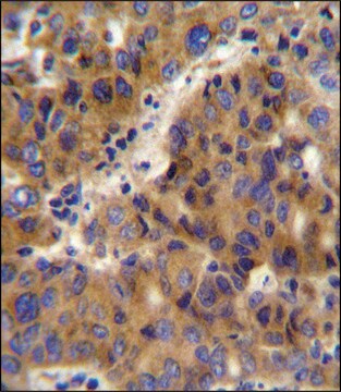 ANTI-BCKDHB (N-TERM) antibody produced in rabbit IgG fraction of antiserum, buffered aqueous solution