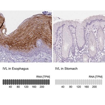 Anti-IVL antibody produced in rabbit Prestige Antibodies&#174; Powered by Atlas Antibodies, affinity isolated antibody, buffered aqueous glycerol solution