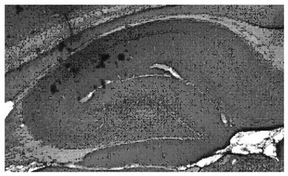 Anti-Sodium channel Nav1.7 Antibody, clone N68/6 clone N68/6, from mouse