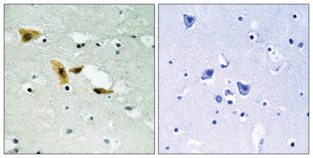 Anti-APLF antibody produced in rabbit affinity isolated antibody