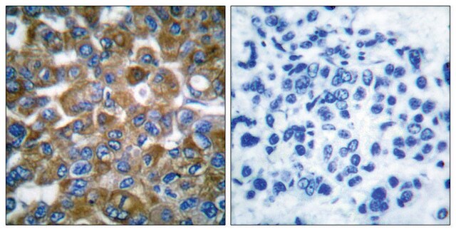 Anti-Keratin 15 antibody produced in rabbit affinity isolated antibody