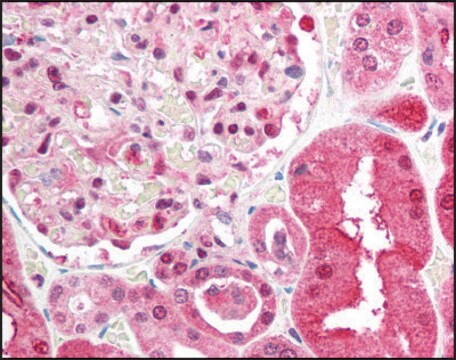 Anti-BRCC3 antibody produced in rabbit affinity isolated antibody, buffered aqueous solution