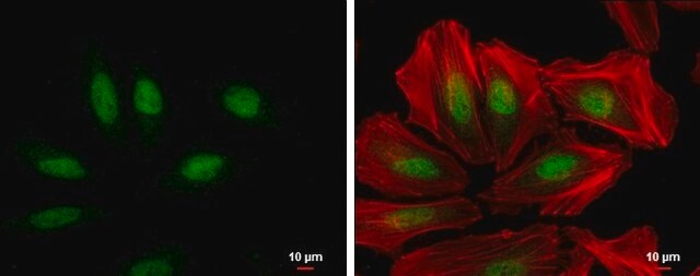 Monoclonal Anti-XPC antibody produced in mouse