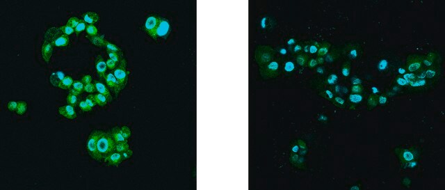 BioTracker&#8482; Putrescine Polyamine Green Fluorescent Live Cell Probe