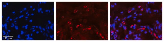 Anti-GAA antibody produced in rabbit affinity isolated antibody