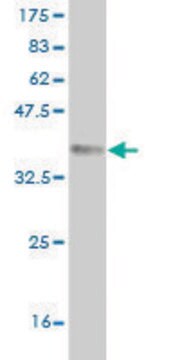 Monoclonal Anti-QPCT antibody produced in mouse clone 4E11, purified immunoglobulin, buffered aqueous solution