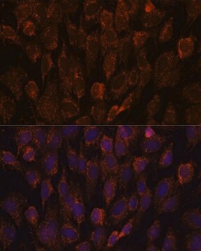 Anti-NSDHL antibody produced in rabbit