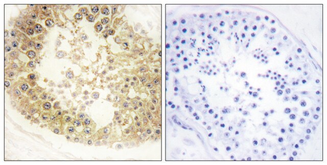 Anti-ECRG4 antibody produced in rabbit affinity isolated antibody