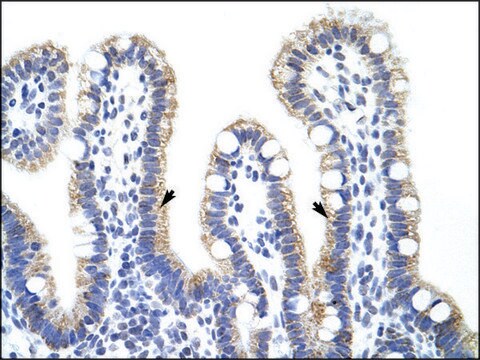 Anti-EXOSC10 antibody produced in rabbit IgG fraction of antiserum