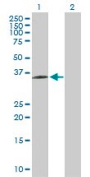 Anti-BDKRB1 antibody produced in rabbit purified immunoglobulin, buffered aqueous solution