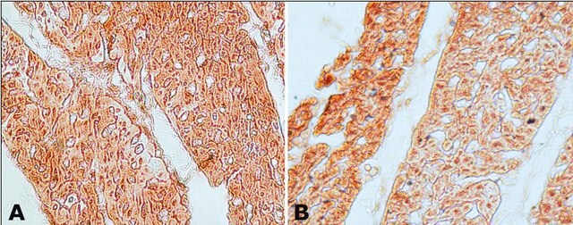 Anti-Guanylyl Cyclase &#946;1 (ER-19) antibody produced in rabbit affinity isolated antibody, buffered aqueous solution