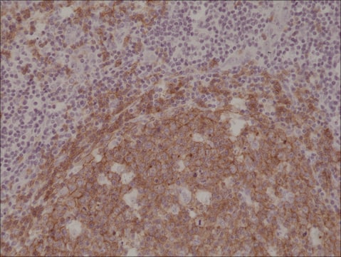 Anti-CD19 antibody, Rabbit monoclonal recombinant, expressed in HEK 293 cells, clone RM332, purified immunoglobulin