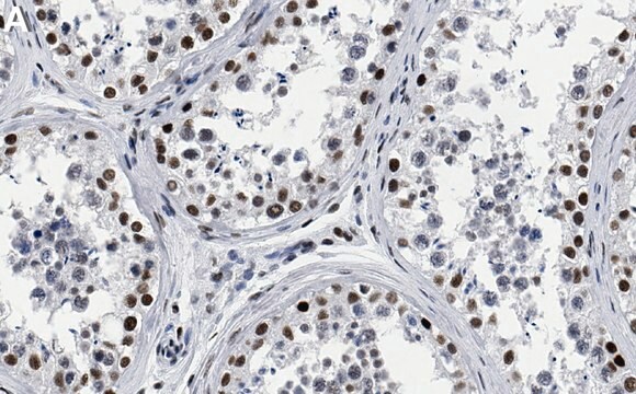 Anti-CBP Antibody, clone 3N20 ZooMAb&#174; Rabbit Monoclonal recombinant, expressed in HEK 293 cells