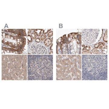 Anti-MRPL18 antibody produced in rabbit Prestige Antibodies&#174; Powered by Atlas Antibodies, affinity isolated antibody, buffered aqueous glycerol solution, ab1