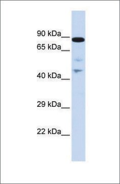 Anti-RAD54L antibody produced in rabbit affinity isolated antibody