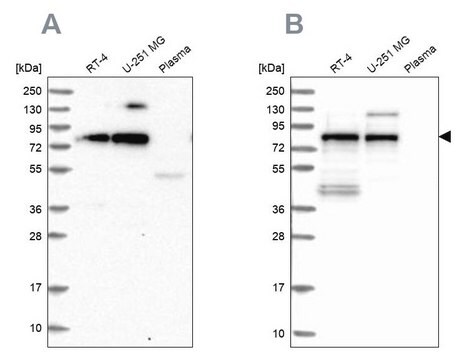 Anti-TNIP1 antibody produced in rabbit Prestige Antibodies&#174; Powered by Atlas Antibodies, affinity isolated antibody, buffered aqueous glycerol solution