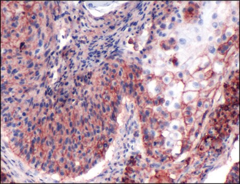 Anti-CD44 antibody, Rabbit monoclonal clone SP37, recombinant, expressed in proprietary host, tissue culture supernatant