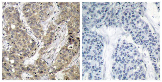 Anti-CTNNB1 (Ab-37) antibody produced in rabbit affinity isolated antibody