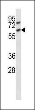 ANTI-MOUSE ACVR1C (C-TERM) antibody produced in rabbit IgG fraction of antiserum, buffered aqueous solution