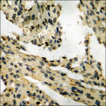 Anti-phospho-Retinoblastoma (pSer795) antibody produced in rabbit affinity isolated antibody