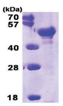 Pentraxin 3 human recombinant, expressed in E. coli, &#8805;90% (SDS-PAGE)