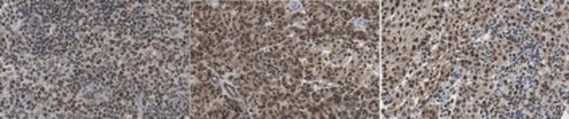 Anti-BMPR-II Antibody, clone 9F4.1 clone 9F4.1, from mouse