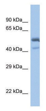 Anti-SPDEF (C-terminal) antibody produced in rabbit affinity isolated antibody