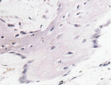 Anti-Bone Sialoprotein II Antibody, CT, clone ID1.2 clone ID1.2, Chemicon&#174;, from mouse