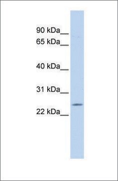 Anti-PSMB5 antibody produced in rabbit affinity isolated antibody