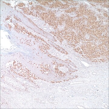 Microphthalmia Transcription Factor (MiTF) (C5/D5) Mouse Monoclonal Antibody